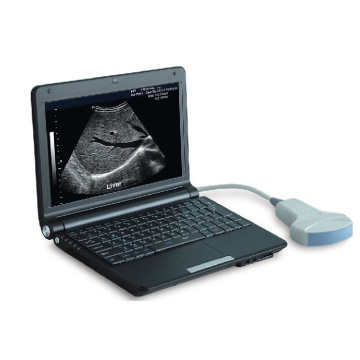 PT3000d1 Laptop Full Digital Ultrasound